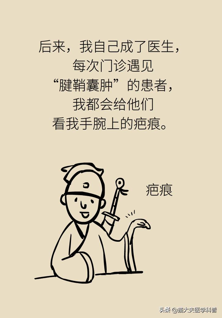 手腕长腱鞘囊肿,手腕上有个凸起的包腱鞘囊肿