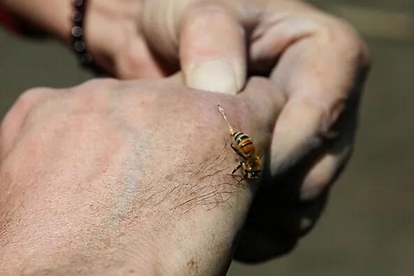 如果不小心被蜜蜂叮伤应该怎么做,宝宝被蜜蜂蛰了第一时间怎么办