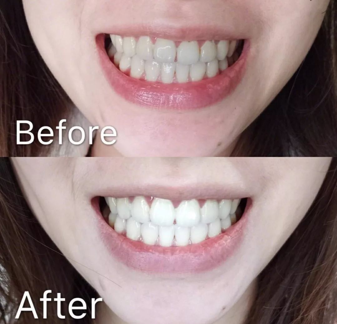 绝佳美人在线阅读,绝佳美人是什么意思