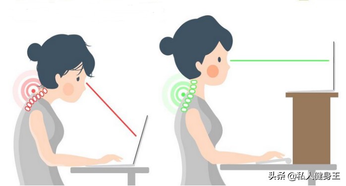 你有什么方法能改善驼背,如果你有驼背现象该怎么办