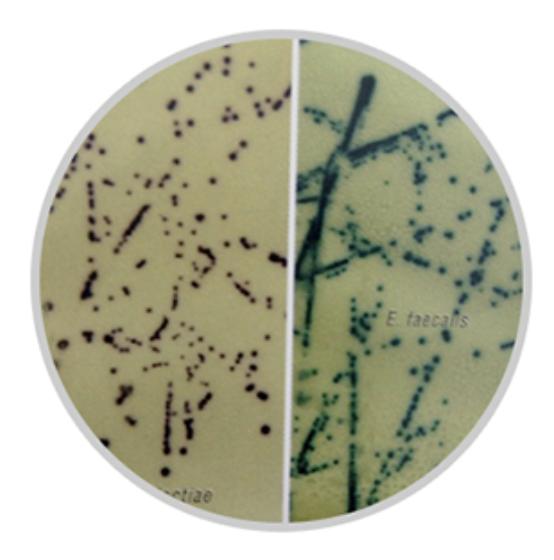 b族链球菌层析法,b族链球菌显色培养是查什么