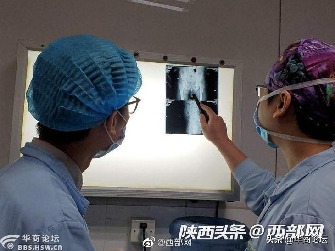 陕西13岁女孩遭姑父暴打,平利一女生遭猥亵