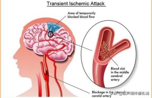 为什么会晕血很严重,晕血导致的晕厥怎么处置