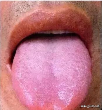 舌头反映了身体的哪些器官,舌头出现信号对身体有什么危险