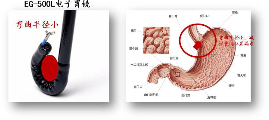国内彩超代表企业对医疗设备的影响——开立医疗(仁成医疗维修)
