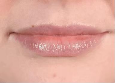 刘涛是全口瓷牙,演员刘涛的一口烤瓷牙多少钱