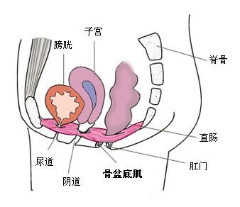盆底肌康复训练凯格尔运动,盆底肌康复仪10大品牌