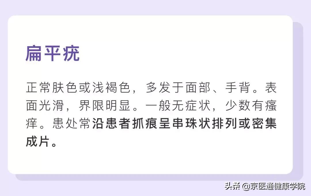 粟丘疹与汗管瘤脂肪粒去除小妙招,粟粒疹扁平疣