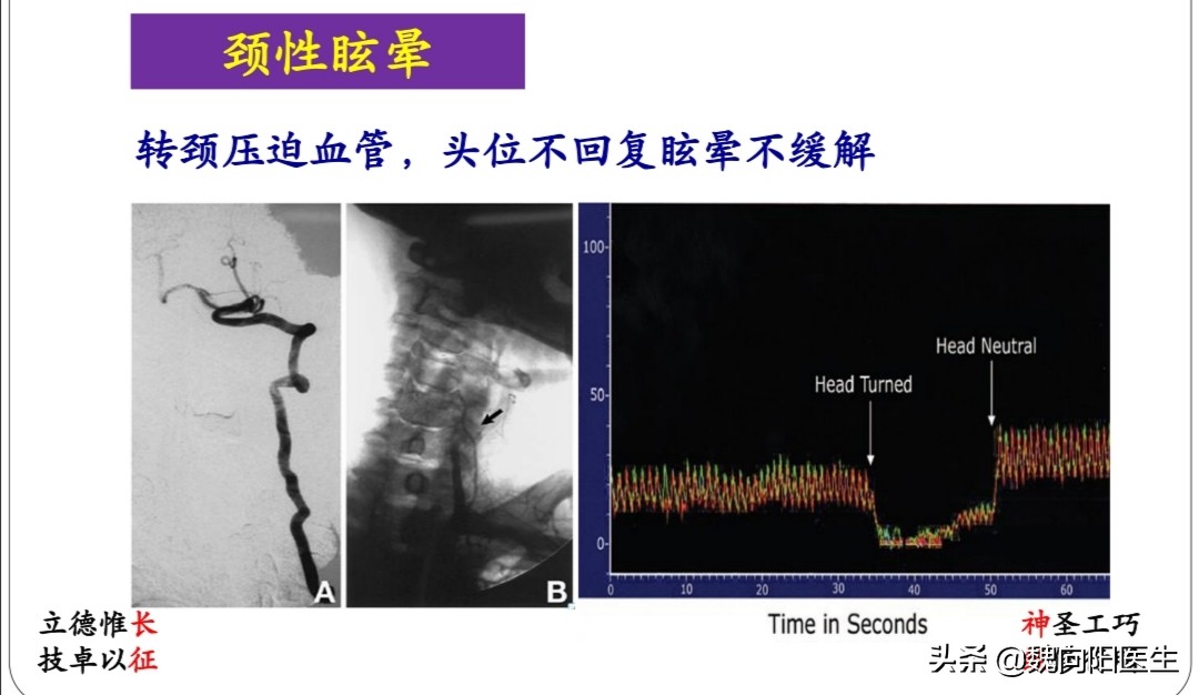 治疗眩晕头晕哪个医院好,头晕眩晕中医看什么科