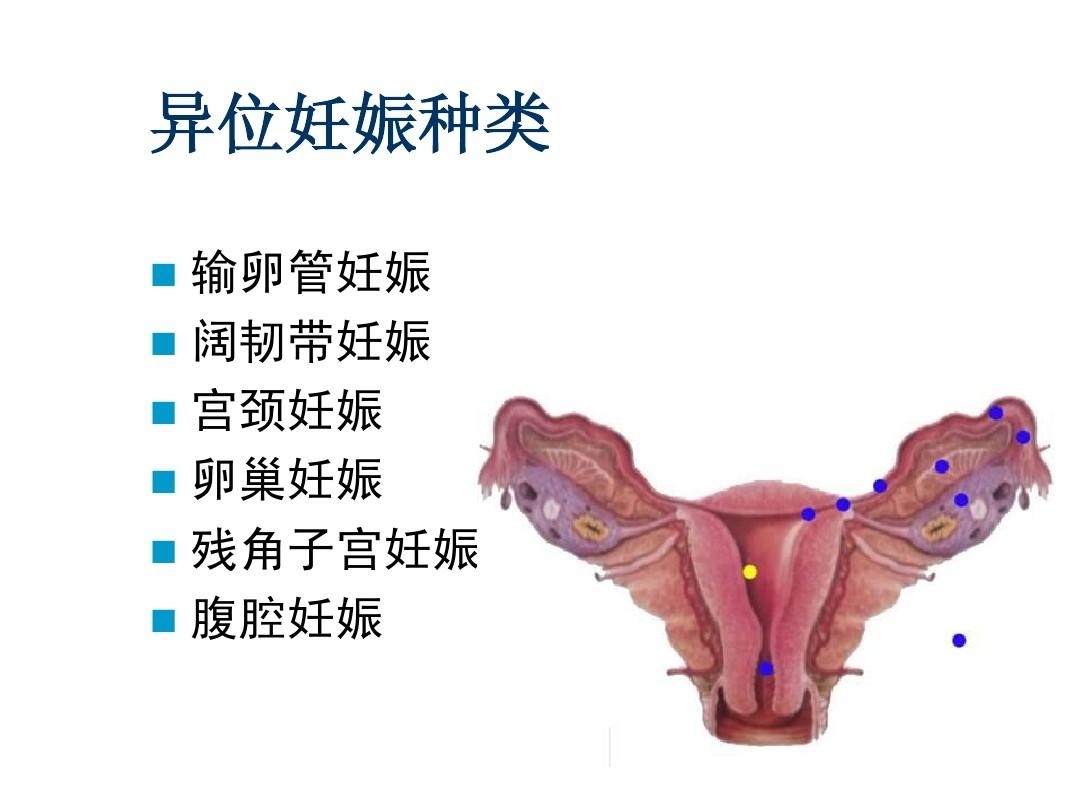 跑偏了的受精卵，竟化身为一颗夺命*弹炸**！