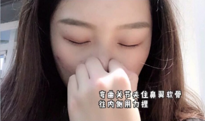 一招教你摆脱蒜头鼻,有啥办法能治蒜头鼻