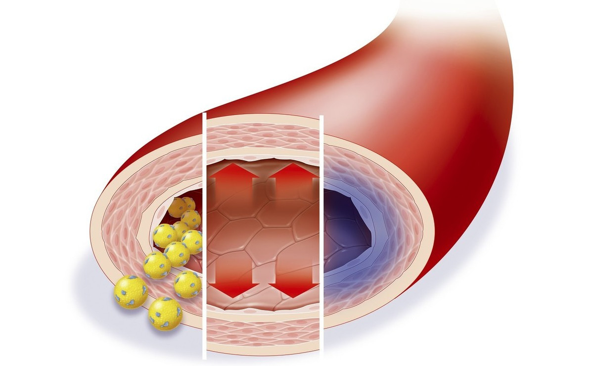 维生素c治好了我的霉菌,维生素c可以辅助治疗银屑病吗