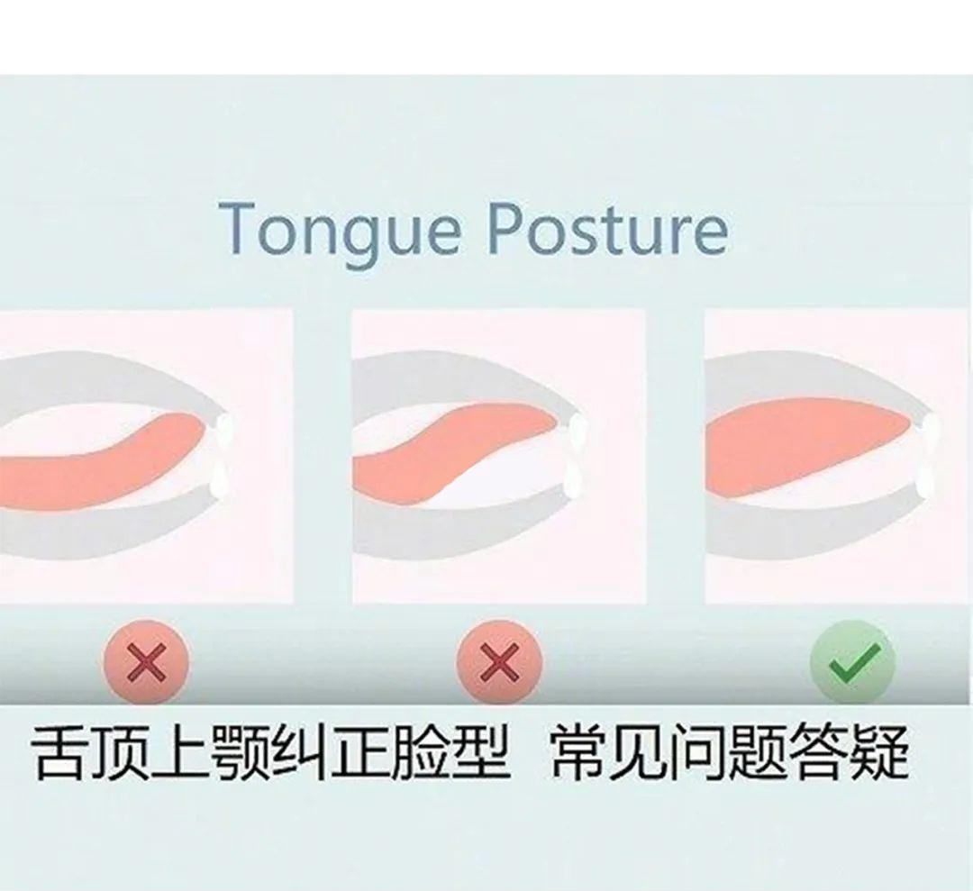 被脸型拖累的颜值,被嘴凸影响的颜值