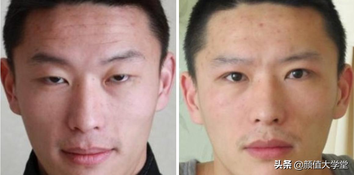 眼睛无神呆滞不灵活,眼睛无神呆滞精神涣散