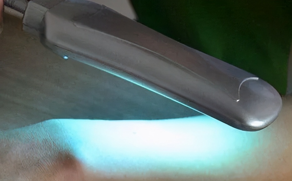 白癜风308光疗仪多少钱一台,白癜风308光疗仪有副作用吗