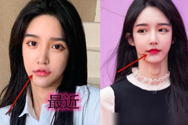 苦瓜脸的人怎么改变,男生苦瓜脸如何保持微笑