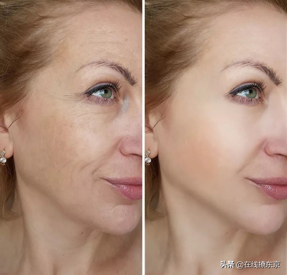 胶原蛋白肽源头,胶原蛋白原料的来源