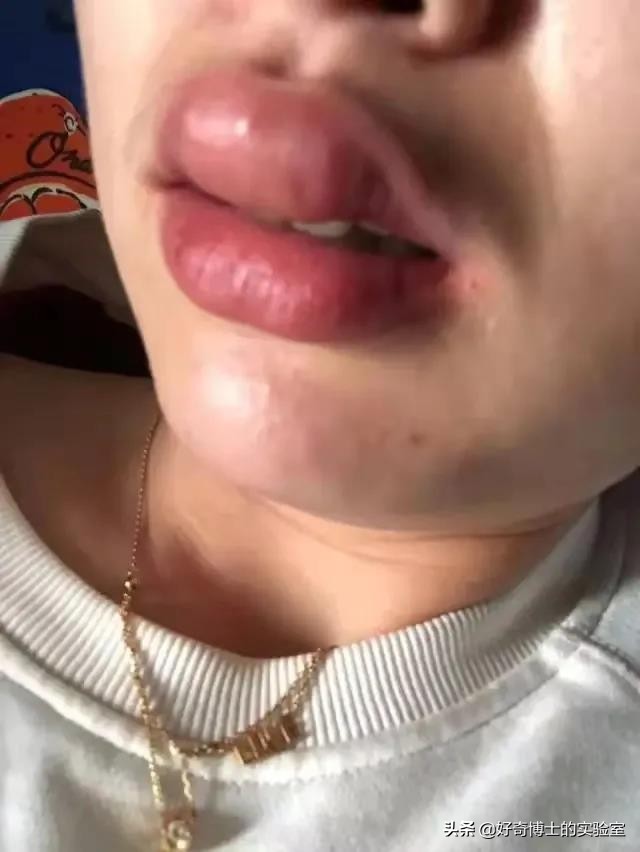 各种搞笑方法干掉蚊子,如何一次干掉100只蚊子