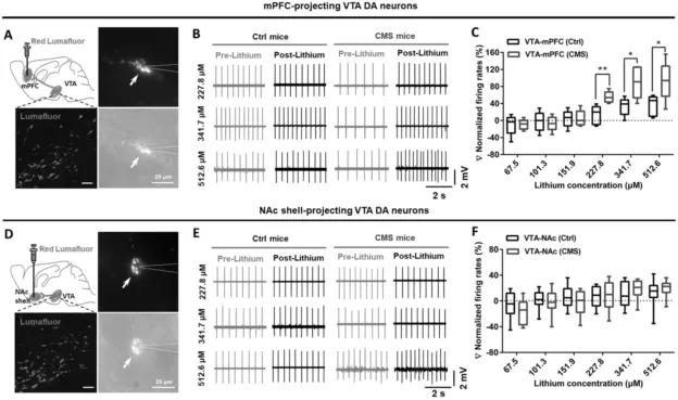 092期抑研报|抑郁症对阿茨海默病中痴呆症状的影响