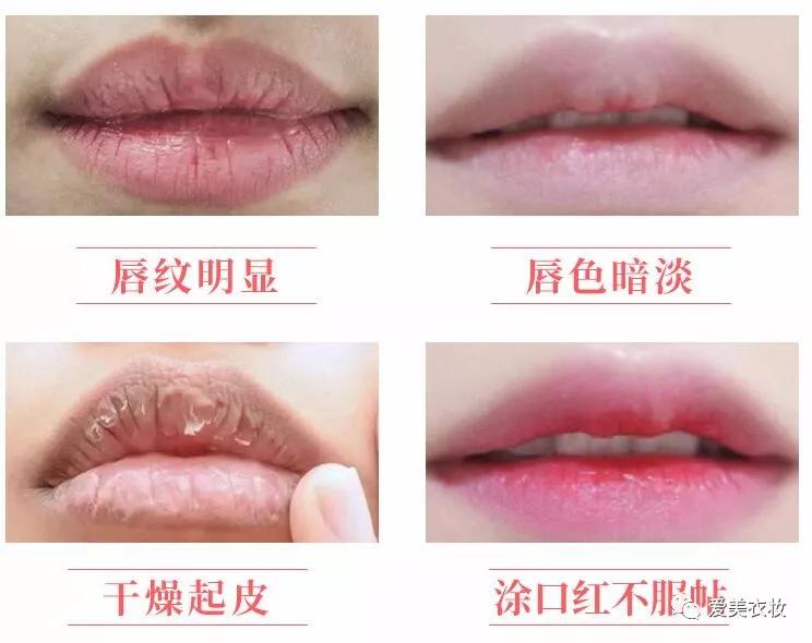 冬天嘴唇干燥开裂怎样保养,一到秋冬嘴唇干裂脱皮怎么办