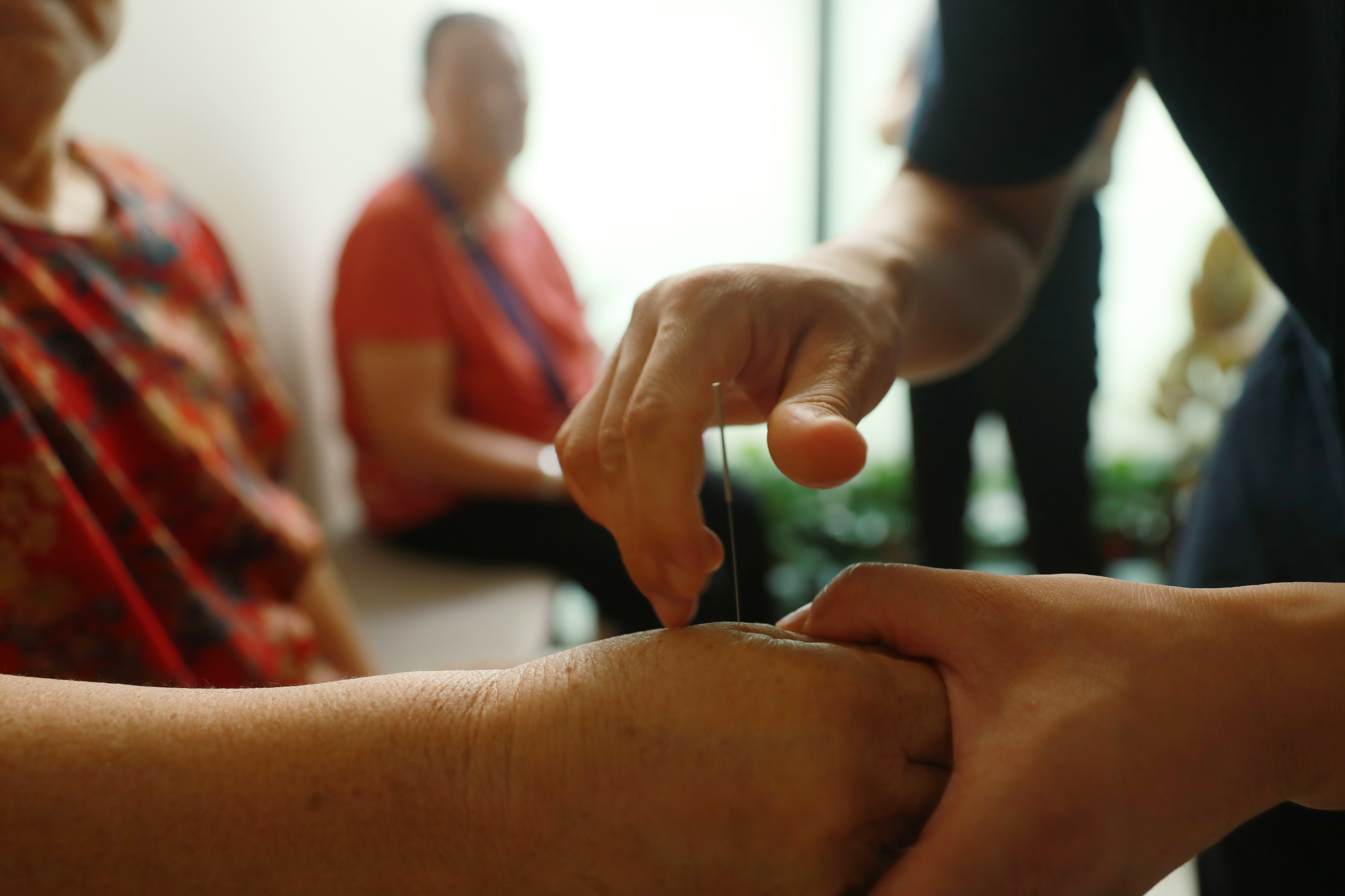 面瘫夏天热怎么办,软瘫期的针灸治疗