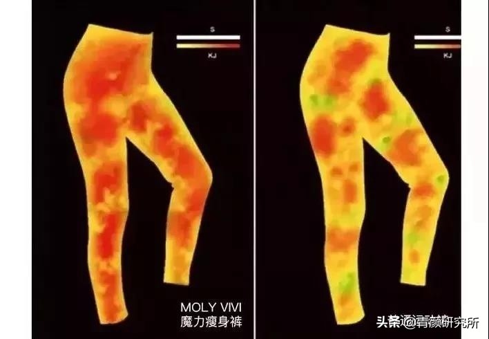 如何一天瘦腿之吴昕瘦腿法,吴昕瘦腿成功靠的是打瘦腿针