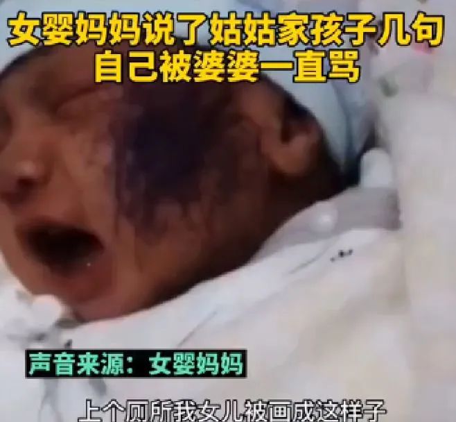满月女儿被画脸,满月母婴脸被亲戚孩子涂画
