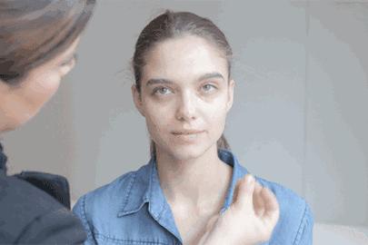 眼周除皱的最佳方法,眼周祛皱术后效果对比