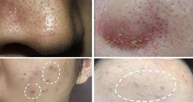 姘ㄥ熀閰稿噣閫忕編鐧芥磥闈钩鐩存挱,姘ㄥ熀閰告场娌礂闈㈠ザ缇庣櫧鐩存挱