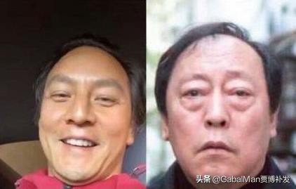 发际线极为危险,发际线有什么讲究