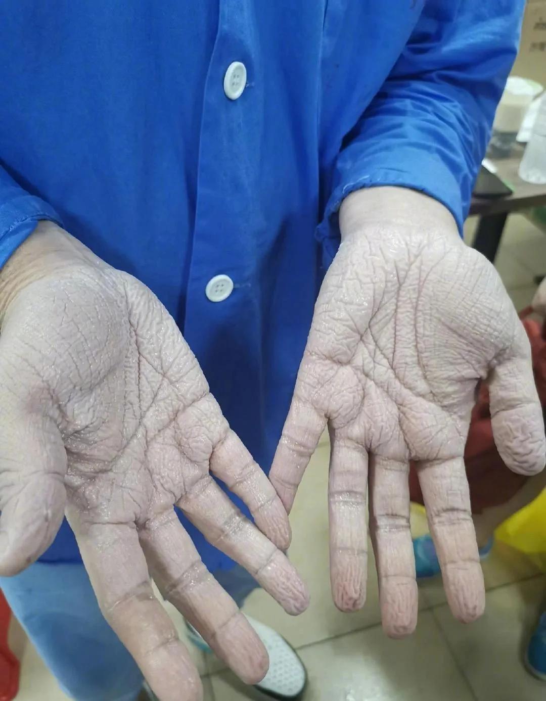 印度毒王最新信息,印度毒王视频