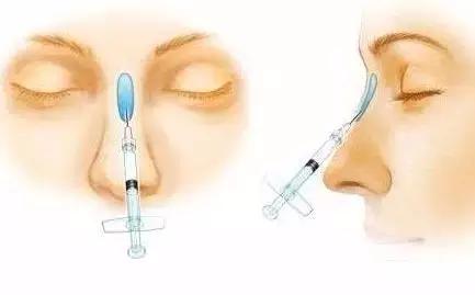 鼻整形后出现肿胀,鼻子整形后假体外露是手术失败吗