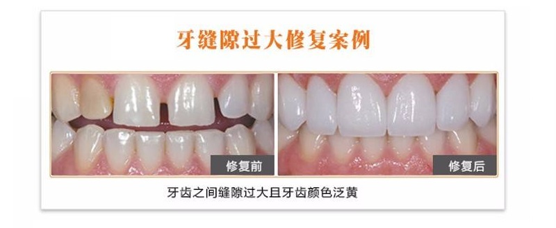 牙科诊所里你不知道的事,口腔医生提醒