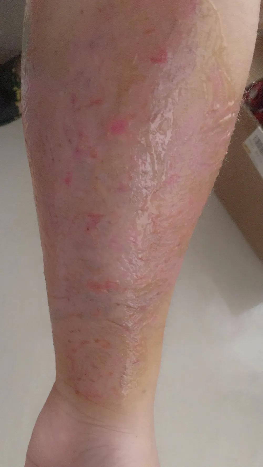 洗文身到底能不能洗干净？