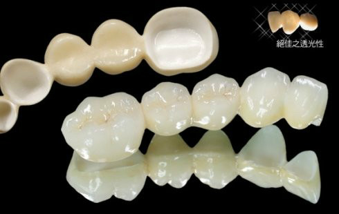 假牙的种类及价格详细介绍图片,目前国内最好的假牙是多少钱