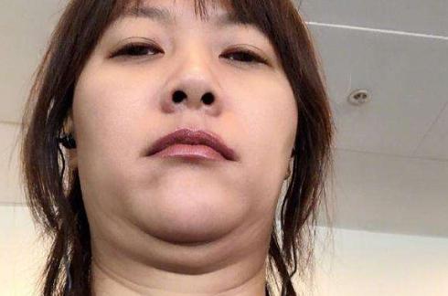 脸大还有双下巴怎么减最有效,胖导致的双下巴怎么解决