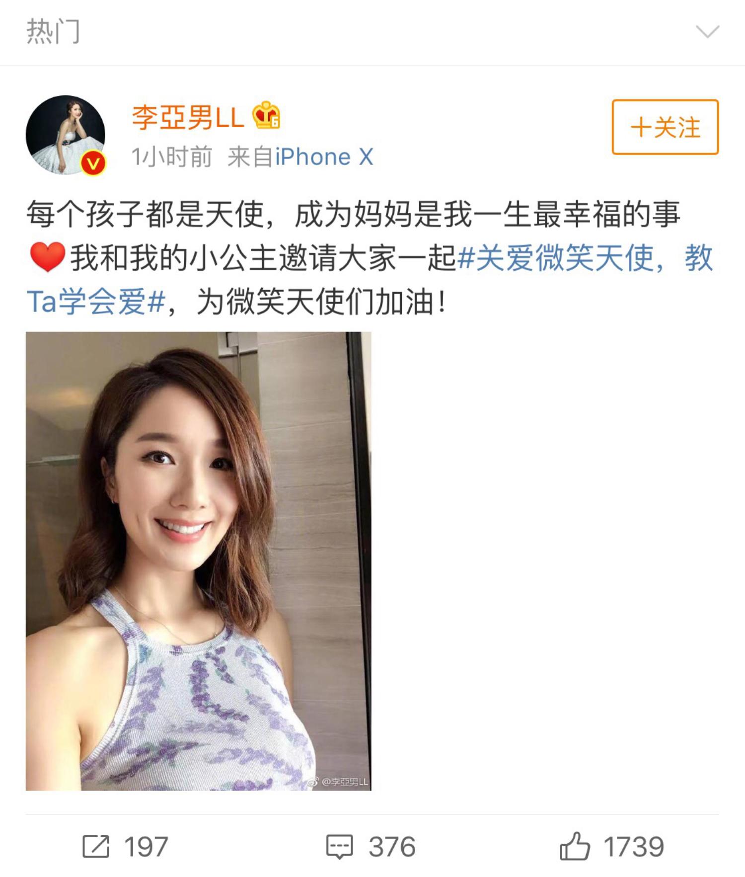 大王携手嫣然天使儿童医院延续四年将公益进行到底