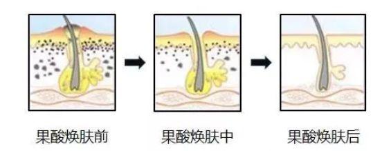 零毛孔让你的皮肤光滑细腻,教你一招搞定毛孔
