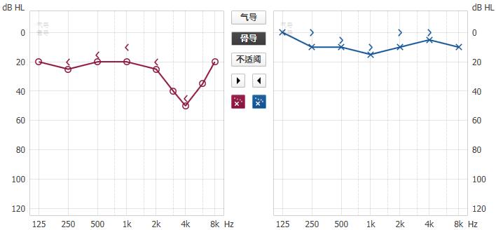 高频听力下降耳鸣会影响低频吗,听力高频下降要哪种品牌助听器