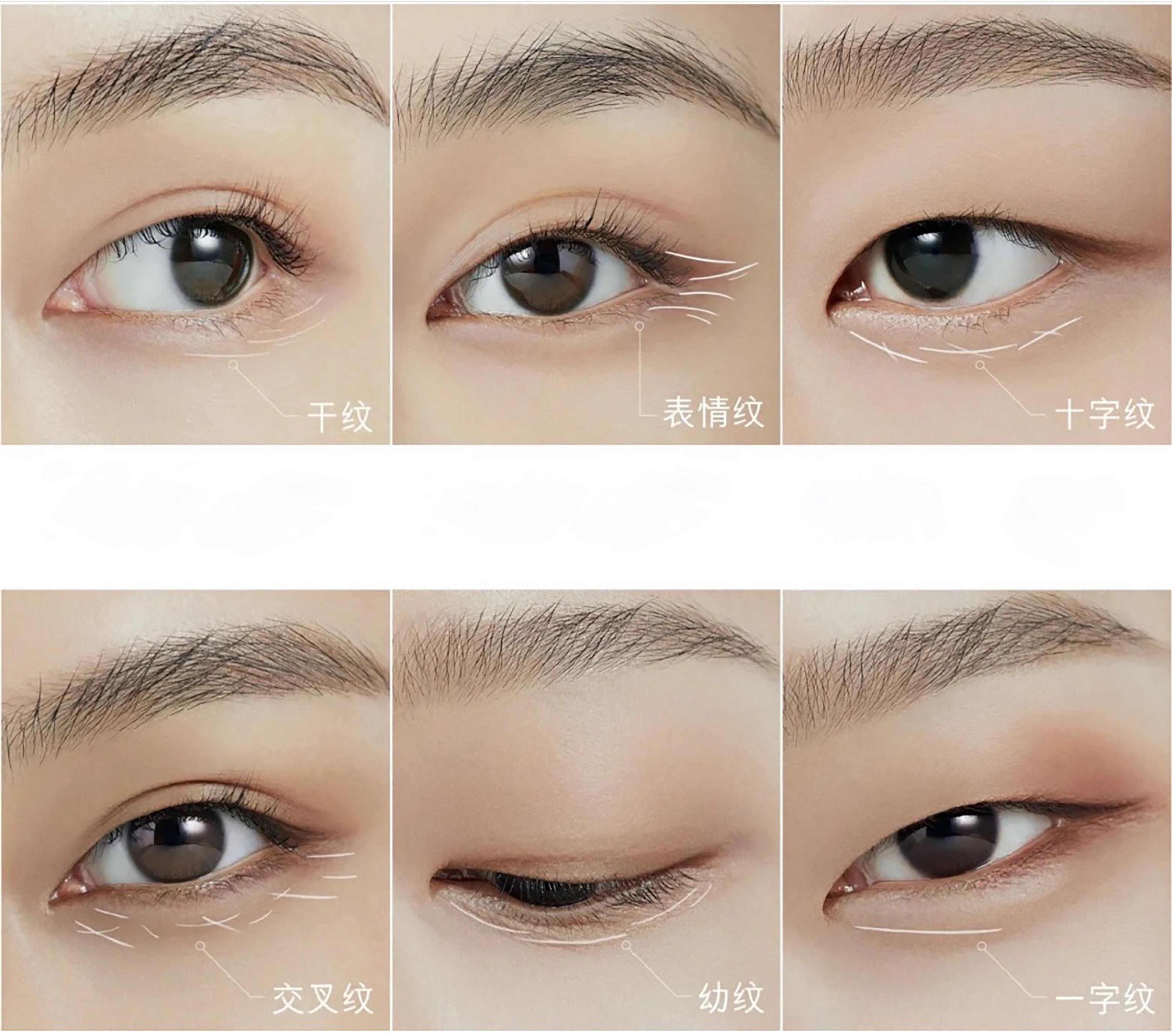 5分钟带你了解眼部问题，面对眼纹不惊慌，快来抄作业