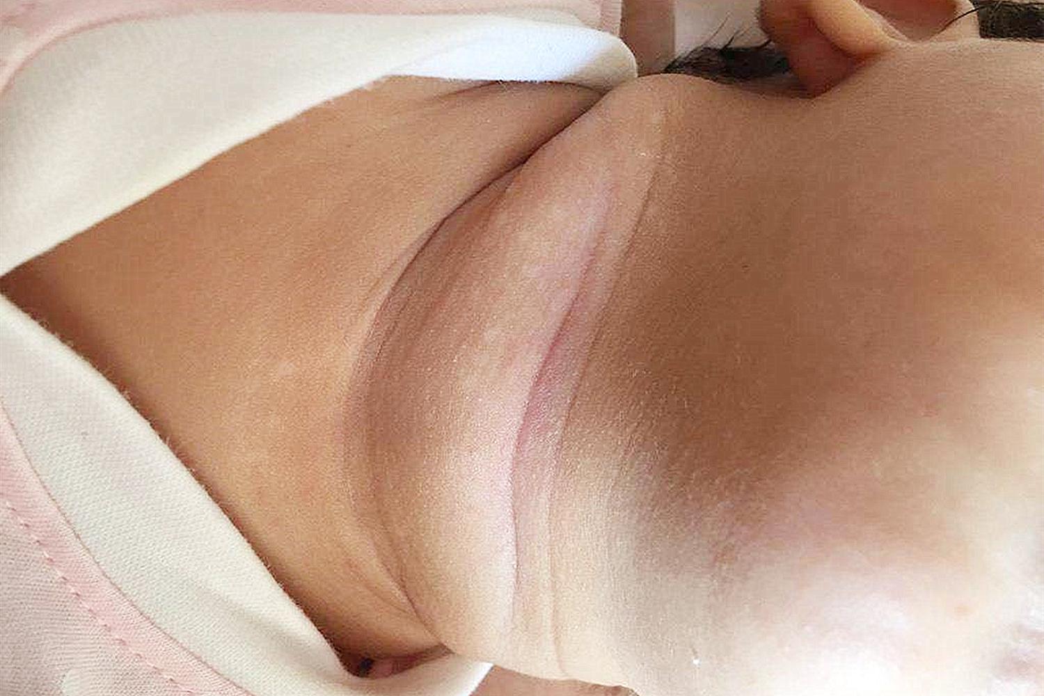 宝宝“淹脖子”太受罪,新手妈妈无从下手,最有用的护理方法在这