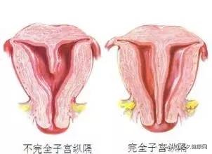 总是怀不上宝宝是什么感觉,总是怀不上要做试管吗