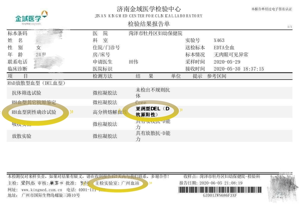 阴性熊猫血有真假吗,真假熊猫血有必要查吗