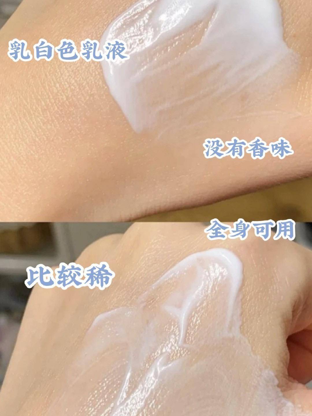 晒后皮肤疼如何快速修复,晒伤后出的晒痕如何处理