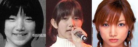 这个你察觉不到的小手术，滨崎步和80%的日本女星都做过它