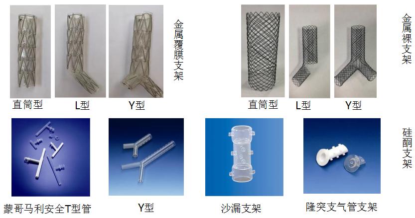 小细胞肺癌的气管镜介入治疗,导航支气管镜在肺癌诊断中的应用