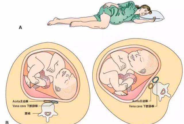 孕期喘不上气吸氧有用吗,孕期经常吃完饭后喘不上来气
