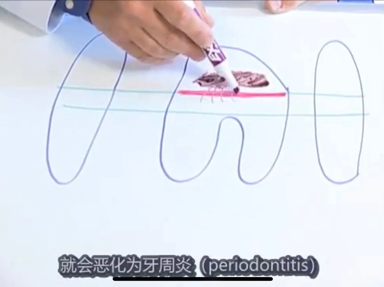 你的猫是否也有一个糟糕的口腔环境？谈谈猫口腔疾病那些事儿