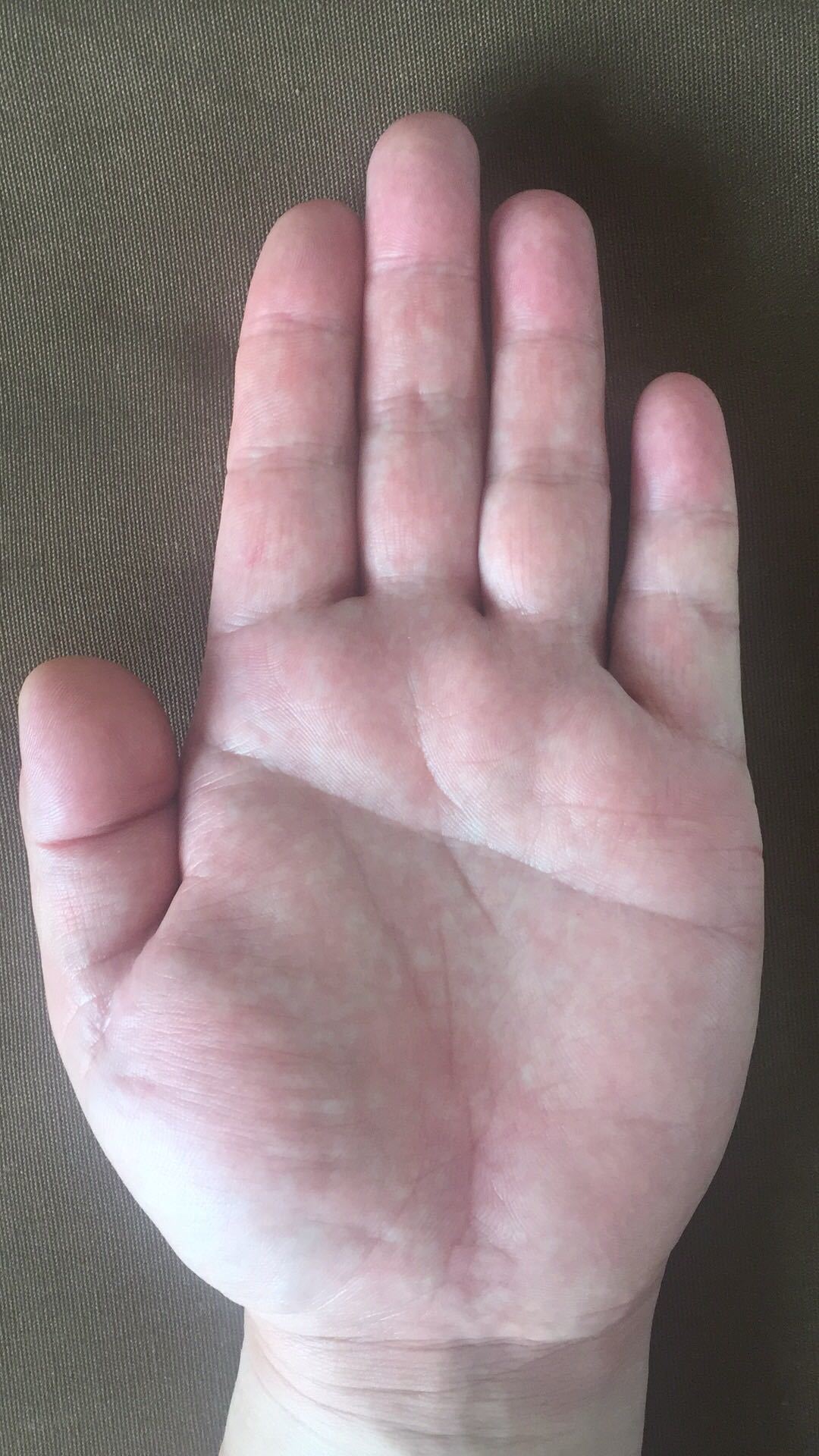 左手手指酸麻胀痛是什么病的前兆,手掌和手指酸麻疼痛是怎么回事