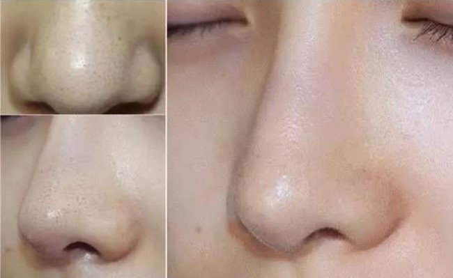 赵丽颖黑头,赵丽颖素颜照片真实对比